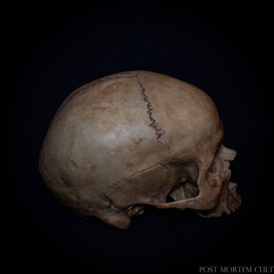 Realistic Human Skull Replica – Designed to replicate the natural organic stains found in real human skulls, this female skull replica is made with the finest polyurethane resin. Its hand-painted finish and authentic weight and size make it a perfect addition to any anatomical study or gothic decor.