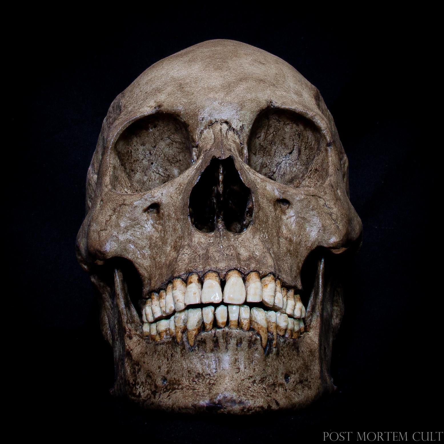 Handcrafted Asian Skull Replica - Anatomically Accurate
Crafted from polyurethane resin, this Asian skull replica offers a lifelike appearance with detailed textures and full dentition. Perfect for scientific displays and collectors, it highlights the anatomy of a 35-45 year old individual.