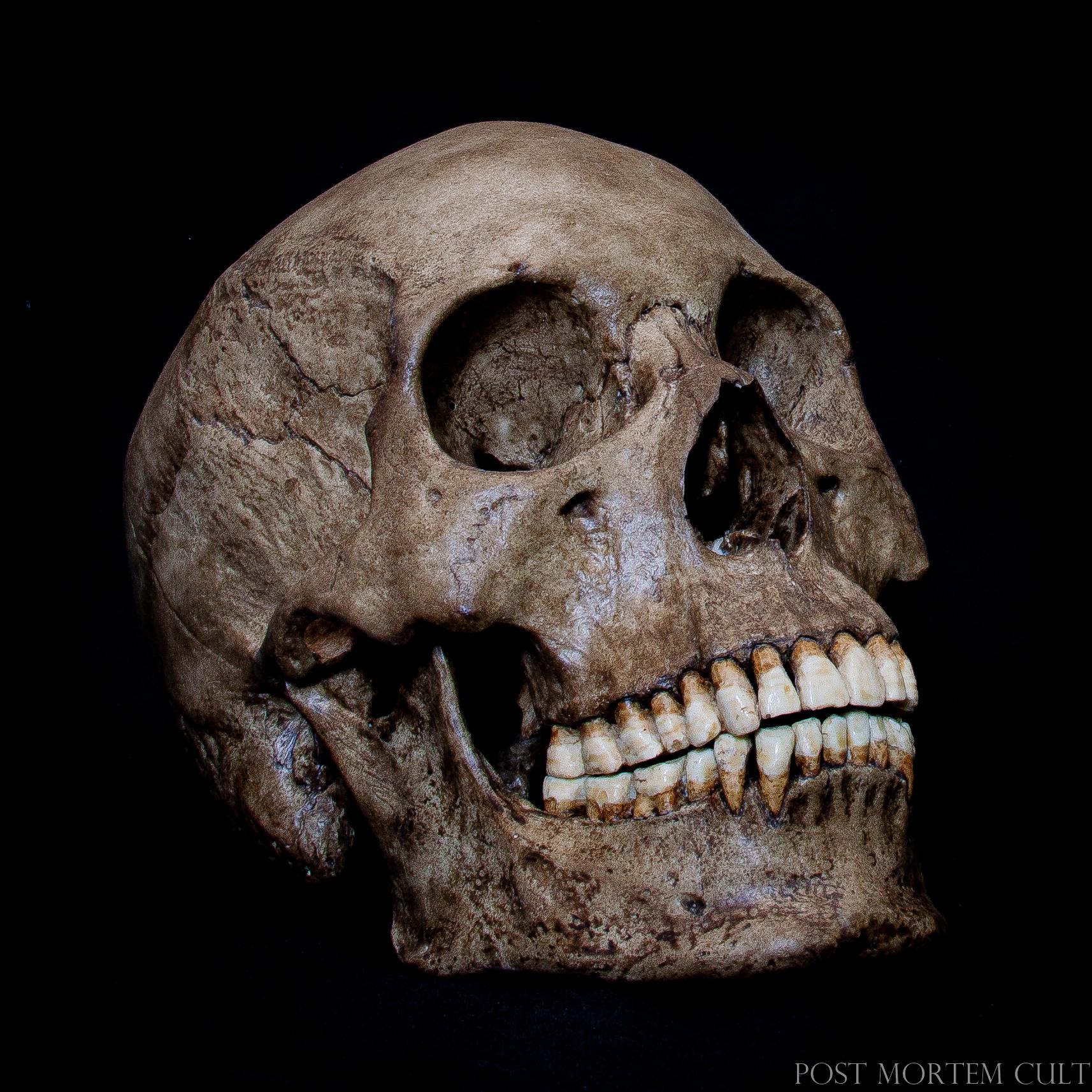 Exceptional Quality Asian Skull Replica with Full Teeth
Our Asian skull replica combines craftsmanship and anatomical accuracy. Featuring full dentition and minimal bone wear, each piece is hand-painted to perfection, offering a realistic and durable model for collectors and anatomical study.