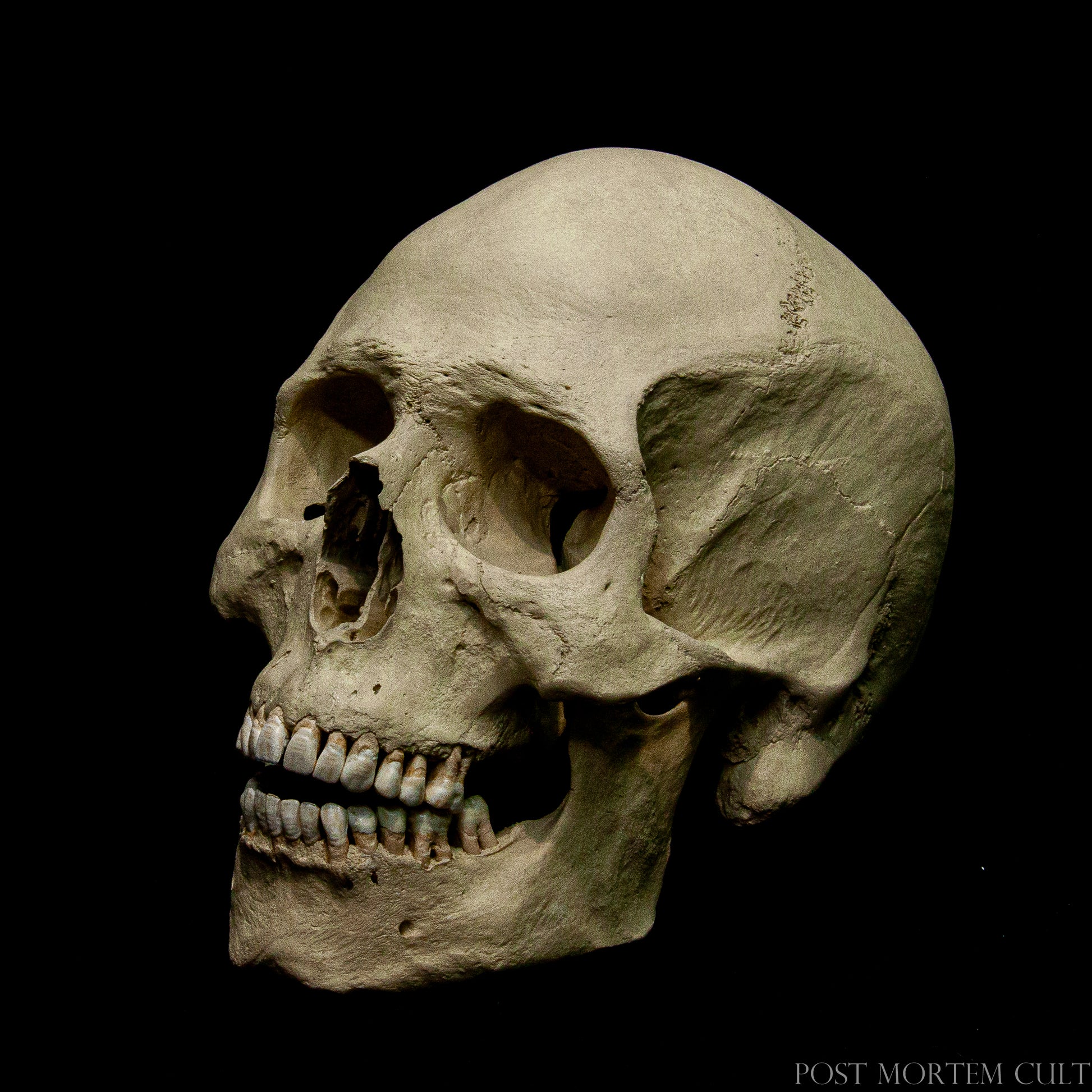 Realistic Anatomical Skull Model - Hand-painted with natural tones and textures for a lifelike appearance.