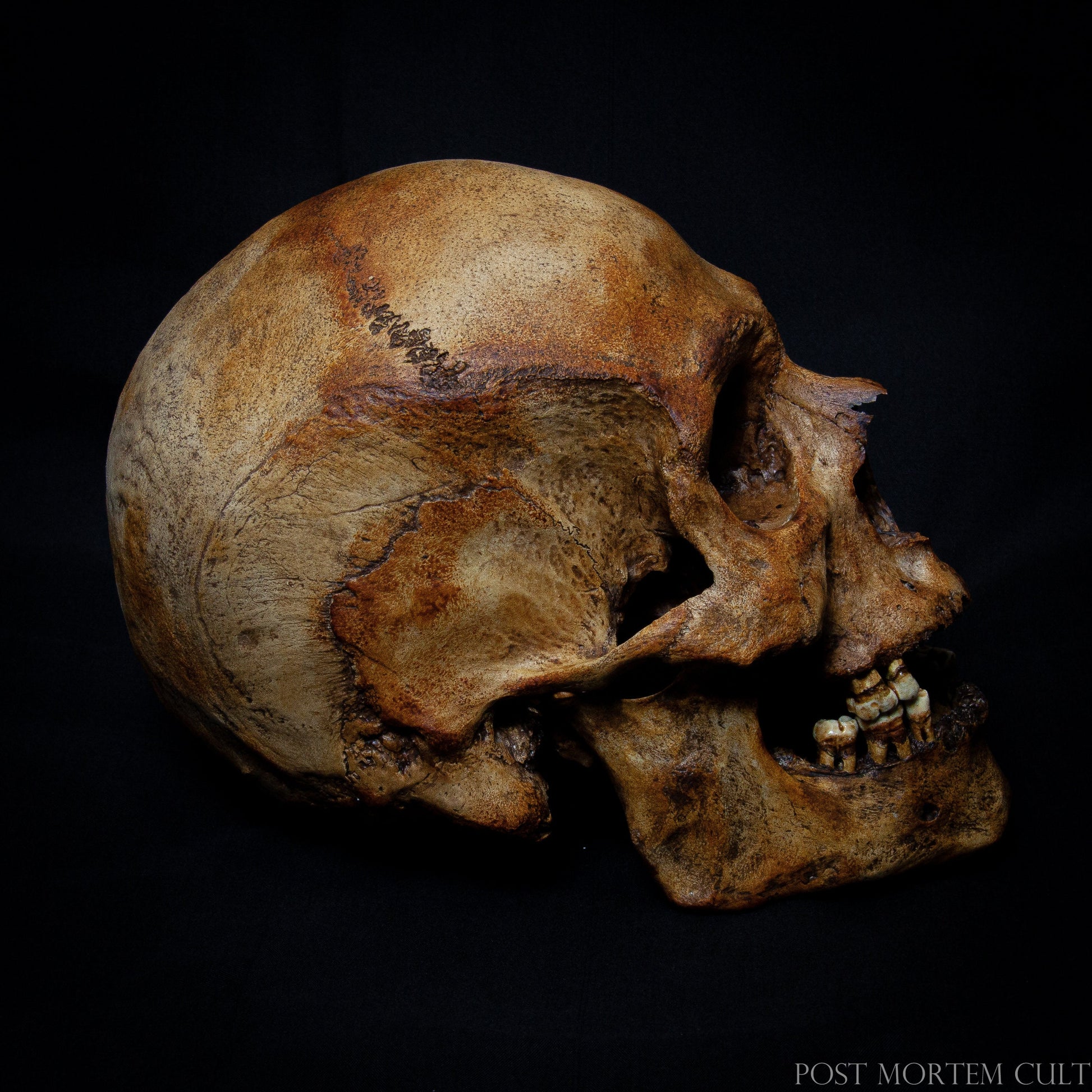 Ideal for Anatomical Studies: With its detailed craftsmanship and realistic bone textures, this male skull replica is perfect for anatomical studies, education, or medical collections.