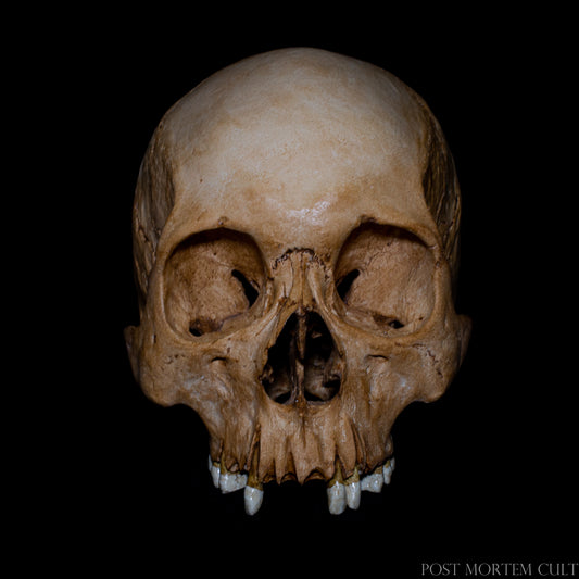 Three-quarter front perspective of the anatomical skull replica, showcasing the depth of the eye sockets and the natural aging details across the bone surface. The layered tones recreate the authentic appearance of ancient skeletal remains.