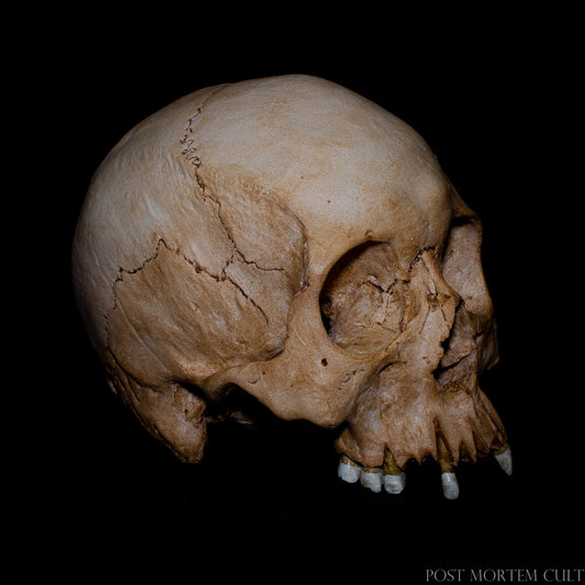 Front view of the Horror Vacui skull replica, highlighting the orbital cavities, nasal opening and worn dental structures. This 1:1 scale anatomical skull reproduces the natural character of historical skeletal remains with striking realism.
