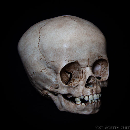 This realistic replica of a 16-month-old child’s skull is expertly crafted from polyurethane resin and features meticulously hand-painted details. With a focus on anatomical accuracy, it showcases the open fontanelle, early bone development, and the texture of human bone. Whether for artistic education, studies, or decor, this skull replica makes an excellent addition to any collection.