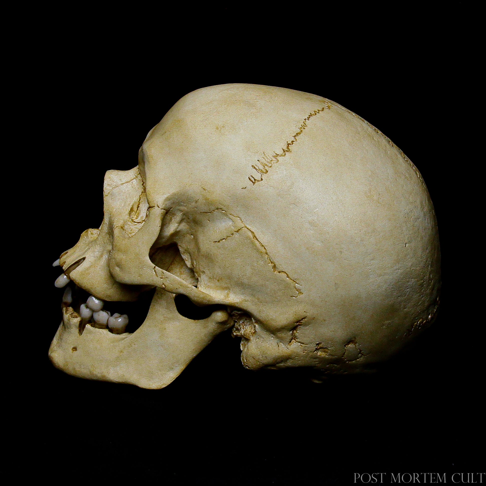 Close-Up of Sutures and Bone Texture:
Zoom in on the meticulously replicated sutures and bone texture of this realistic skull. A remarkable piece for those who appreciate fine craftsmanship and anatomical precision.