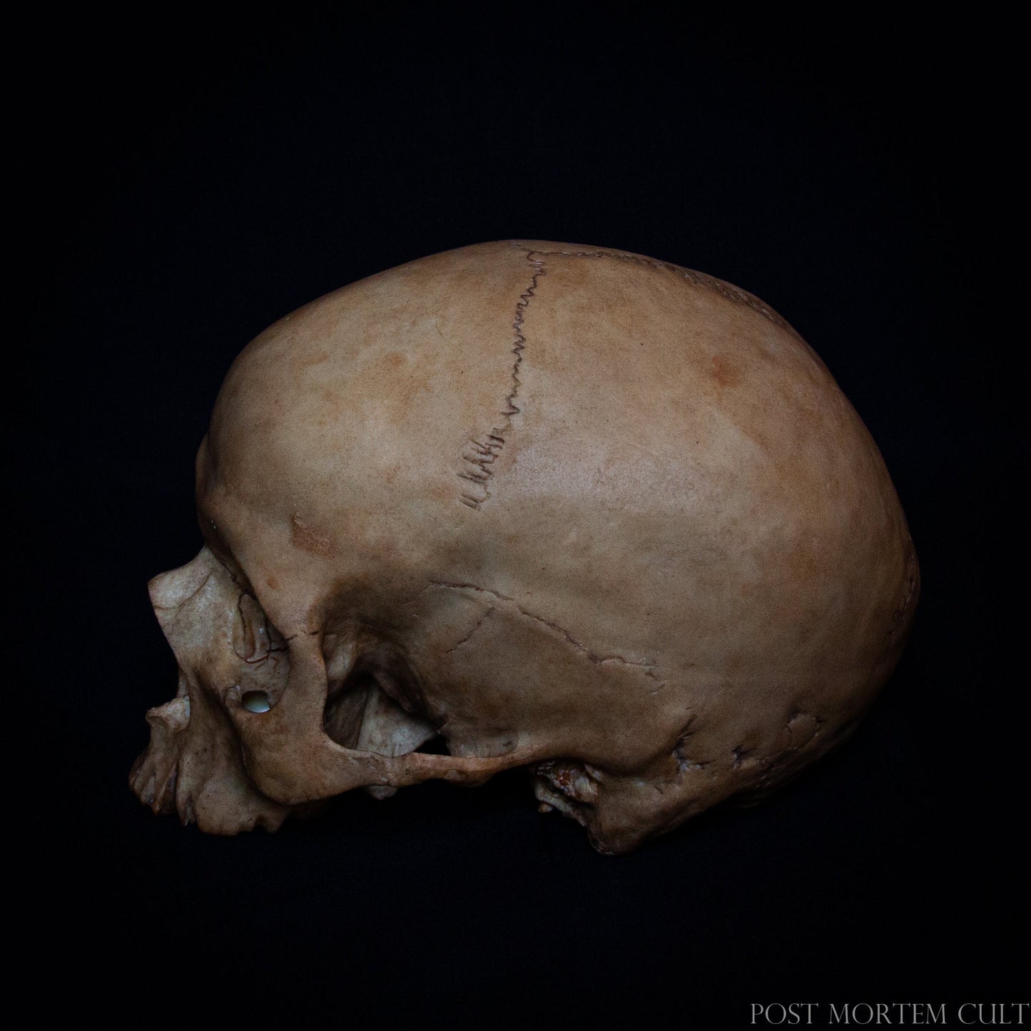 Authentic Female Skull Model – This female skull replica features realistic beige sand tones and organic detailing, closely mimicking a genuine human skull. The hand-painted finish and authentic dimensions make it an essential item for medical collectors or anyone interested in the human anatomy.