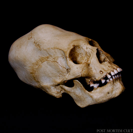 This hand-painted Paracas elongated skull replica is an exceptional piece for anatomical studies, historical education, or as a unique collectible. Crafted in polyurethane resin, it authentically reflects the ancient Paracas civilization with precision and intricate details.