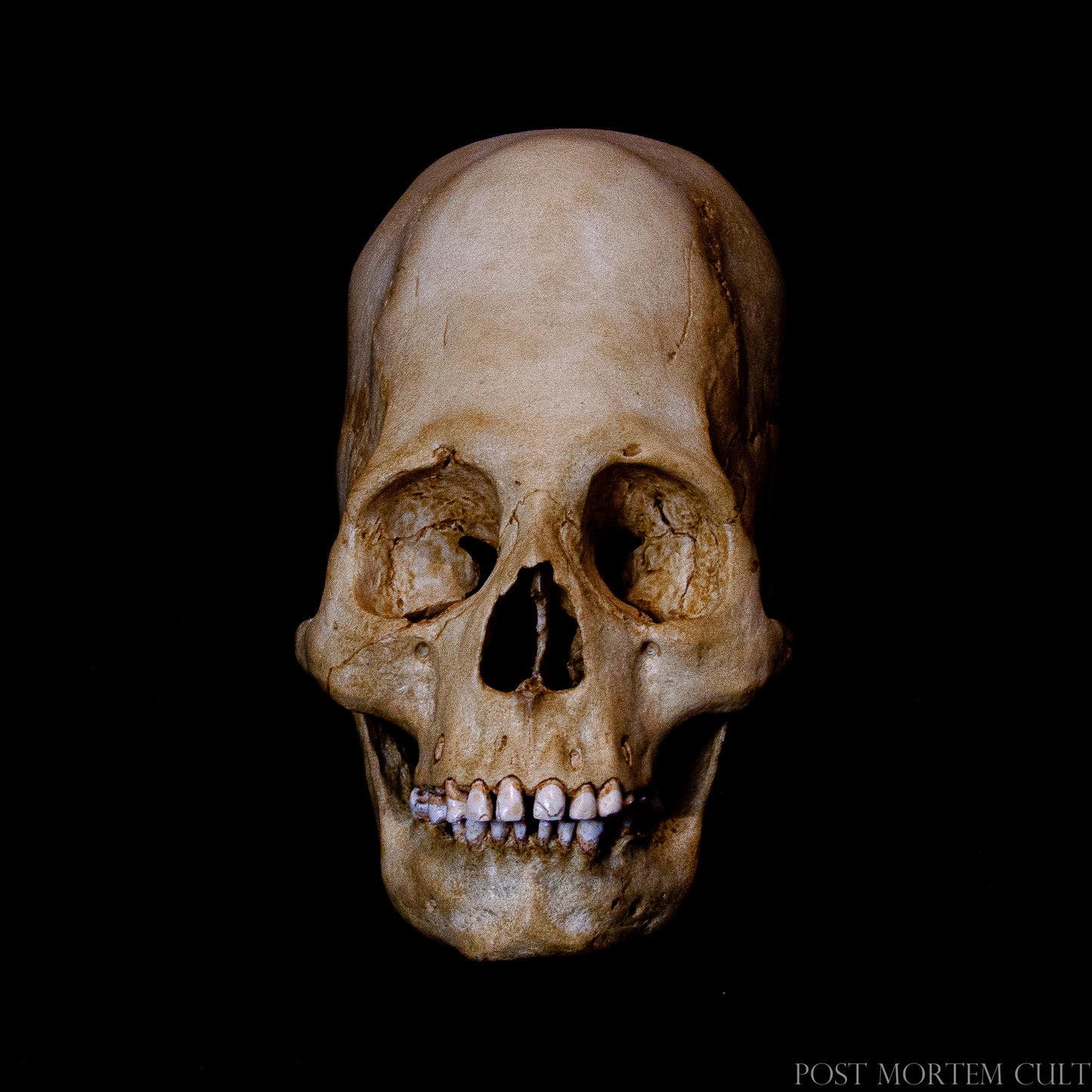 This Paracas skull replica is meticulously crafted in polyurethane resin, offering high-quality details and a stunning bone-like texture. It’s a perfect addition for collectors of ancient artifacts and historians looking to explore the fascinating culture of Paracas.