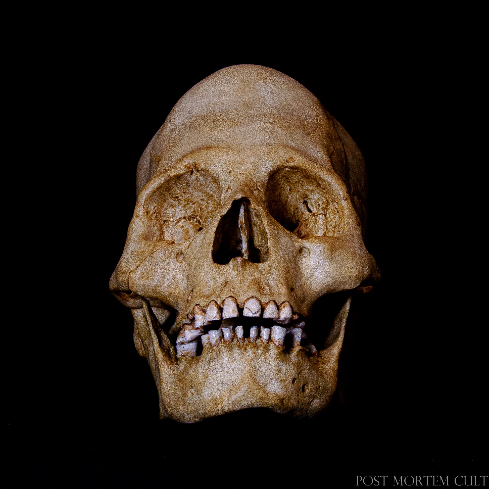 Featuring a hand-painted design and highly detailed texture, this Paracas skull replica beautifully captures the ancient tradition of cranial deformation. Its accurate depiction of an elongated skull makes it a historically significant collectible for any museum or curiosity cabinet.