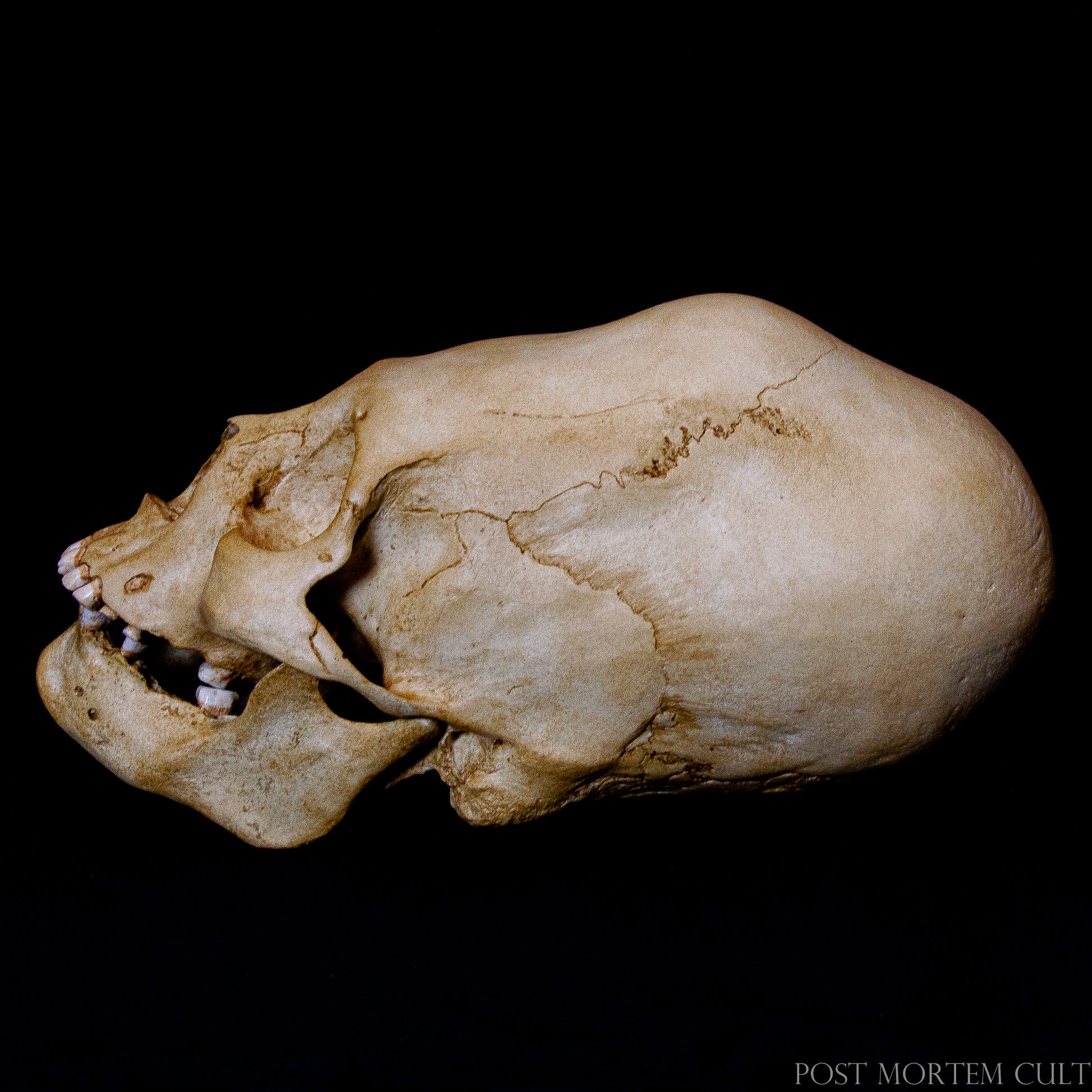 This Paracas elongated skull replica is not only an extraordinary collectible piece, but also a tribute to the ancient cultures of Peru. With its authentic appearance and fine craftsmanship, it’s perfect for any historical collection or anatomical display.