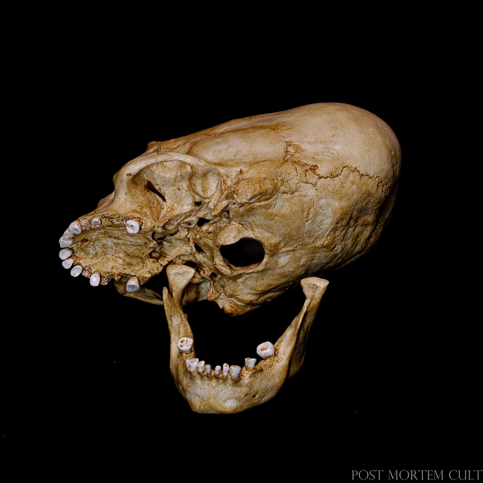 The hand-painted Paracas skull replica offers incredible realism, with an authentic bone texture and subtle details that highlight the unique cranial deformation of the Paracas civilization. It’s a must-have for anyone fascinated by ancient Peruvian history.