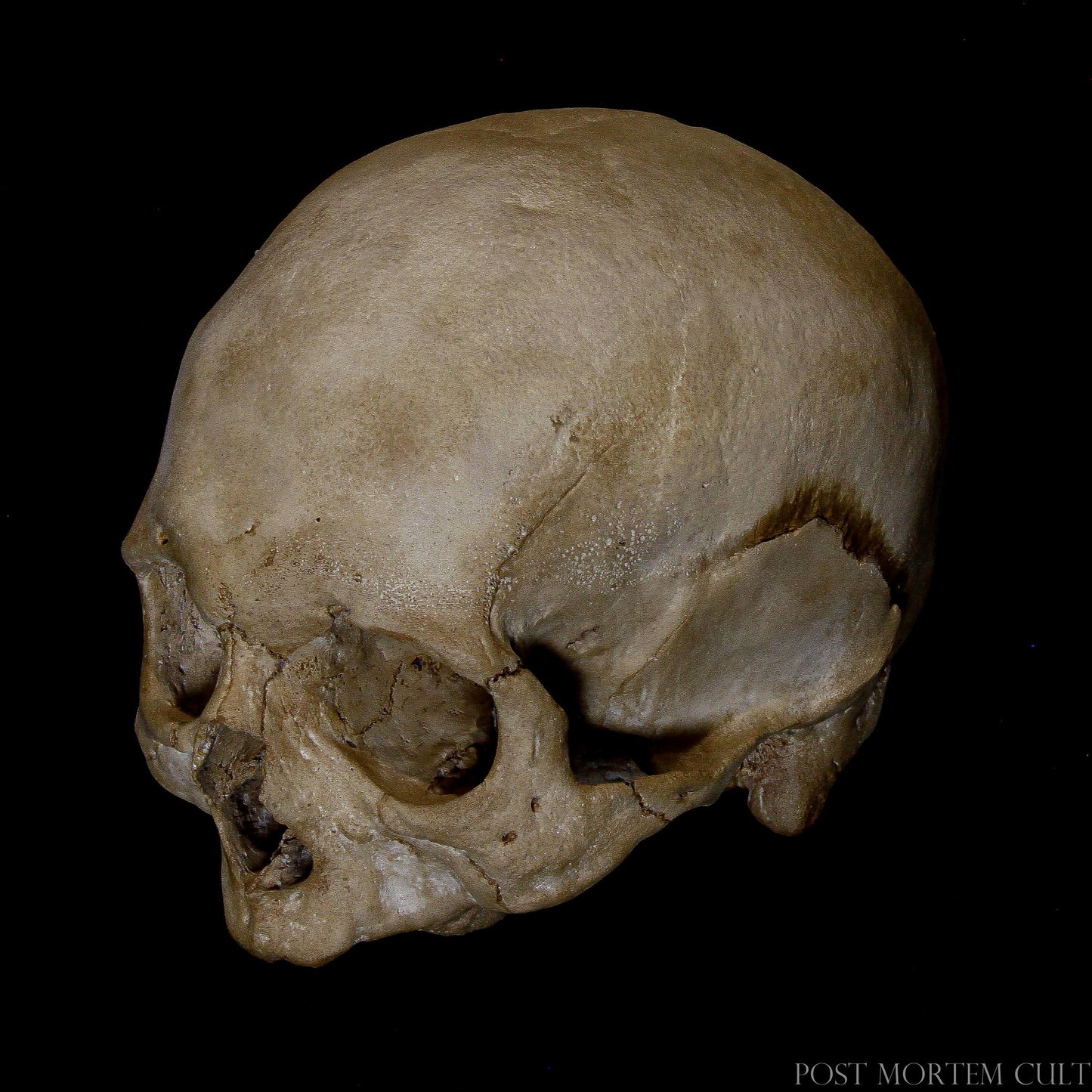 Lifelike Human Skull Model – Replicating the natural wear and tear of an aged human skull, this model features detailed bone texture and realistic features. Ideal for educational purposes, this piece brings the science of human anatomy to life.