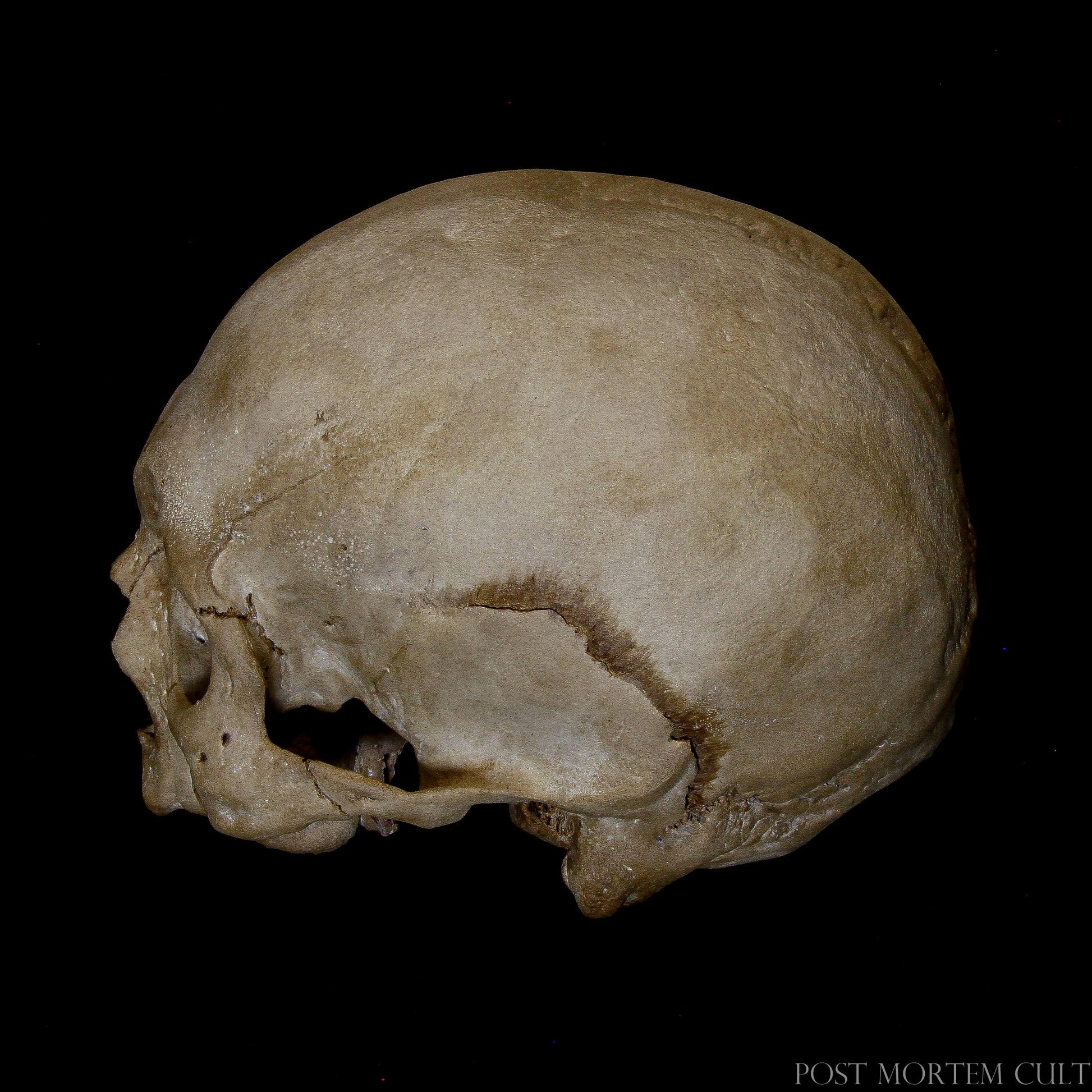 Aged Human Skull Replica – Showcasing advanced age and wear, this detailed human skull replica captures the essence of an older individual with realistic gum erosion, sutural deformities, and weathered bone texture. Painted by hand for a unique, authentic look.