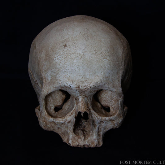 Realistic Ossuary-Style Human Skull Replica – This hand-painted skull replica showcases exceptional detail and authenticity, with visibly worn gums and bone porosity. Designed for collectors and anatomy enthusiasts, it offers a stunningly realistic texture and finish that mirrors a true human skull's aged appearance.