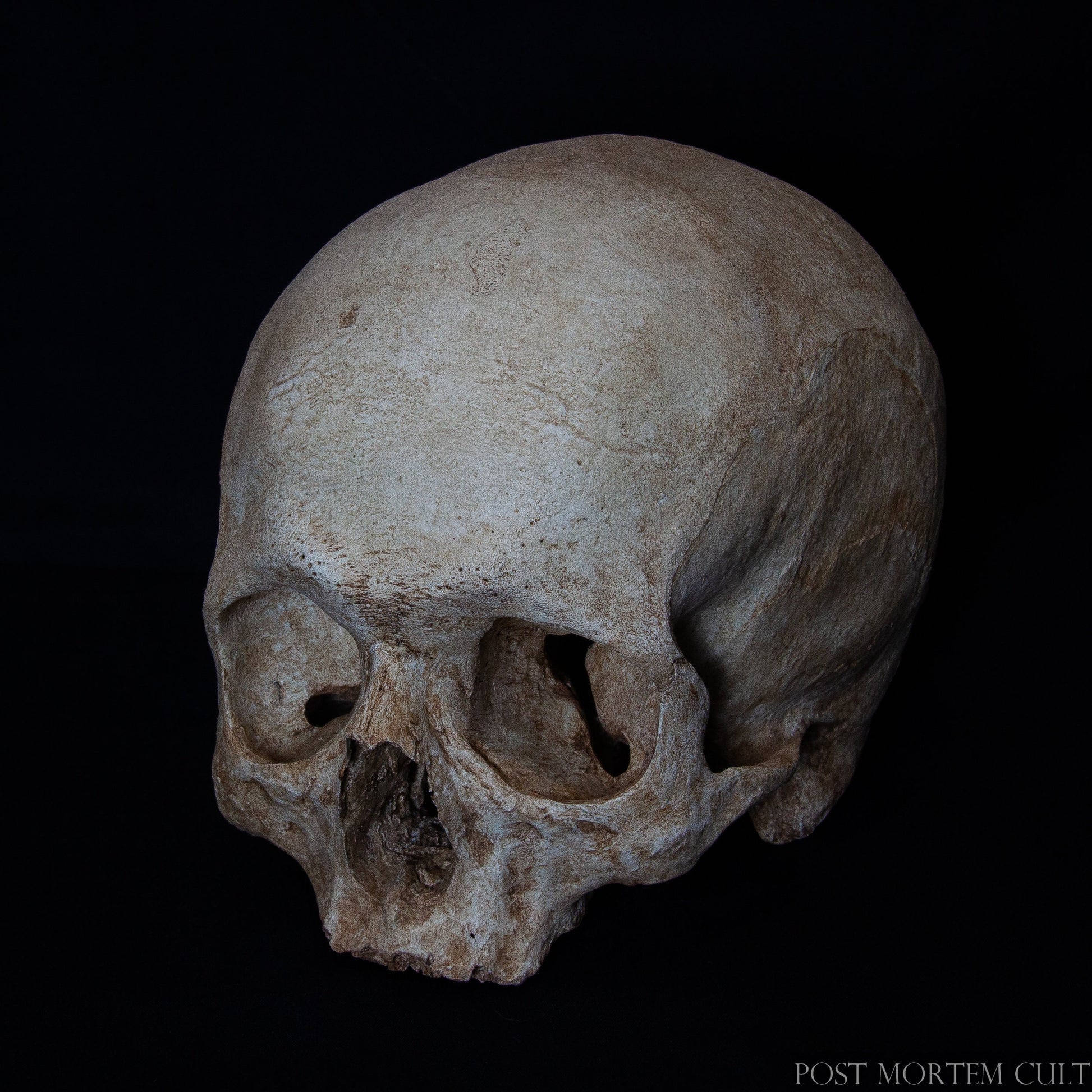 High-Quality Human Skull Replica – Featuring natural bone porosity and a narrow, worn upper jaw, this ossuary-style skull is crafted from durable polyurethane resin. Its hand-painted finish ensures each detail, from the gums to the sutures, is as lifelike as possible, making it a perfect addition to any anatomy study or decorative display.