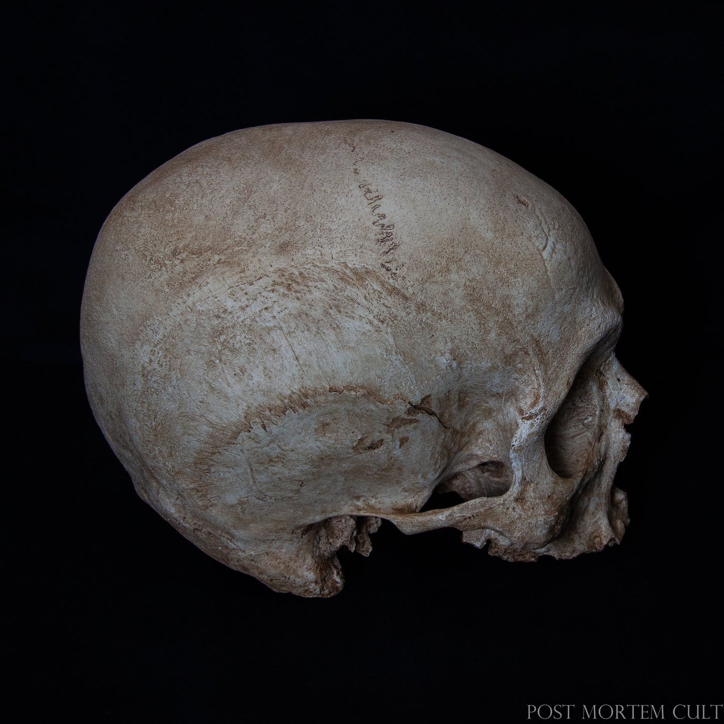 Detailed Ossuary-Style Skull for Collectors – With intricate details like worn gums, bone porosity, and an authentic narrow jaw, this ossuary-style skull replica offers exceptional realism. Perfect for medical students, artists, and gothic collectors, it’s designed to capture the passage of time in high-quality polyurethane resin.