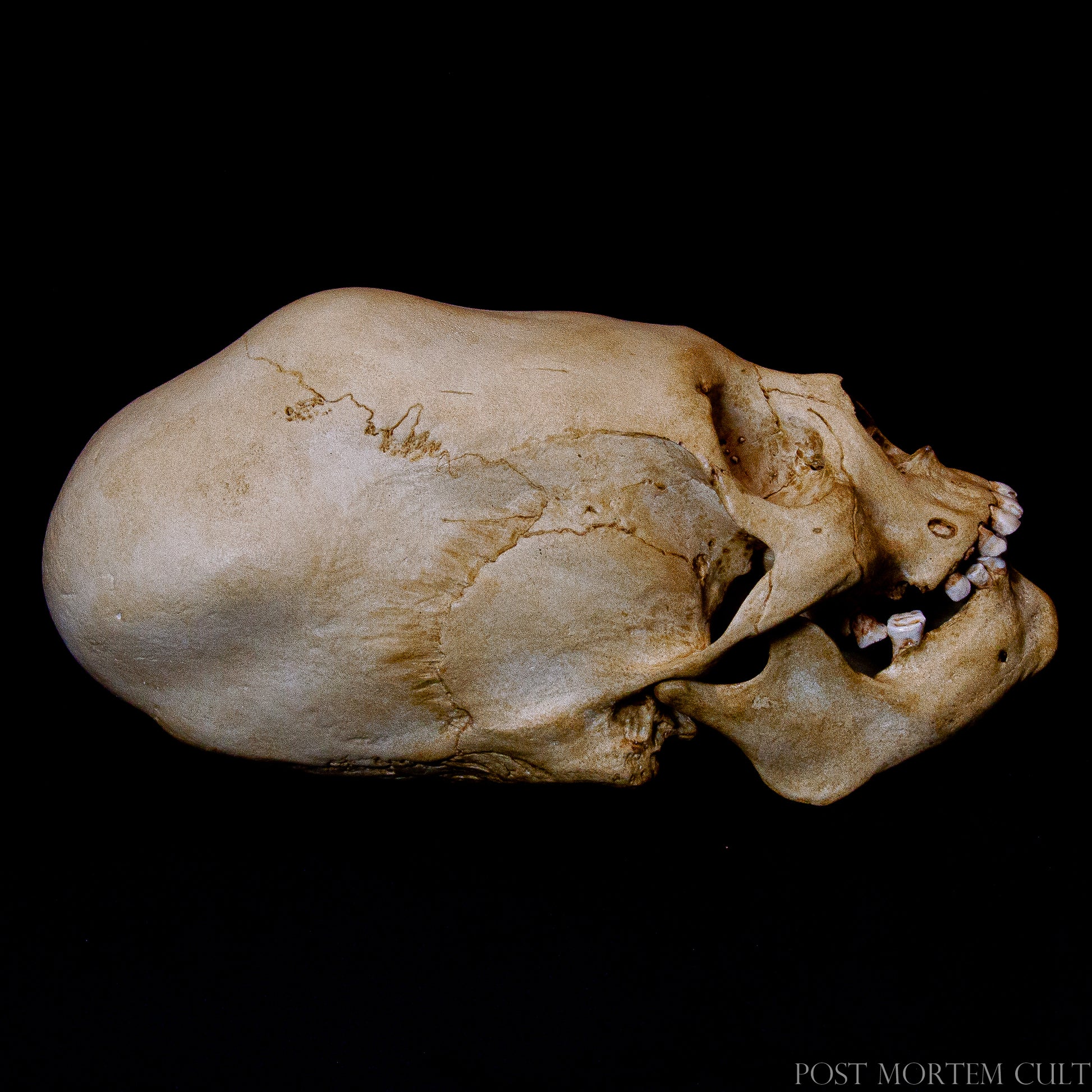 Ideal for anatomical studies and educational purposes, this Paracas skull is an excellent teaching tool for anyone studying ancient civilizations. The hand-painted detailing and lifelike appearance make it an authentic representation of ancient Paracas cranial practices.