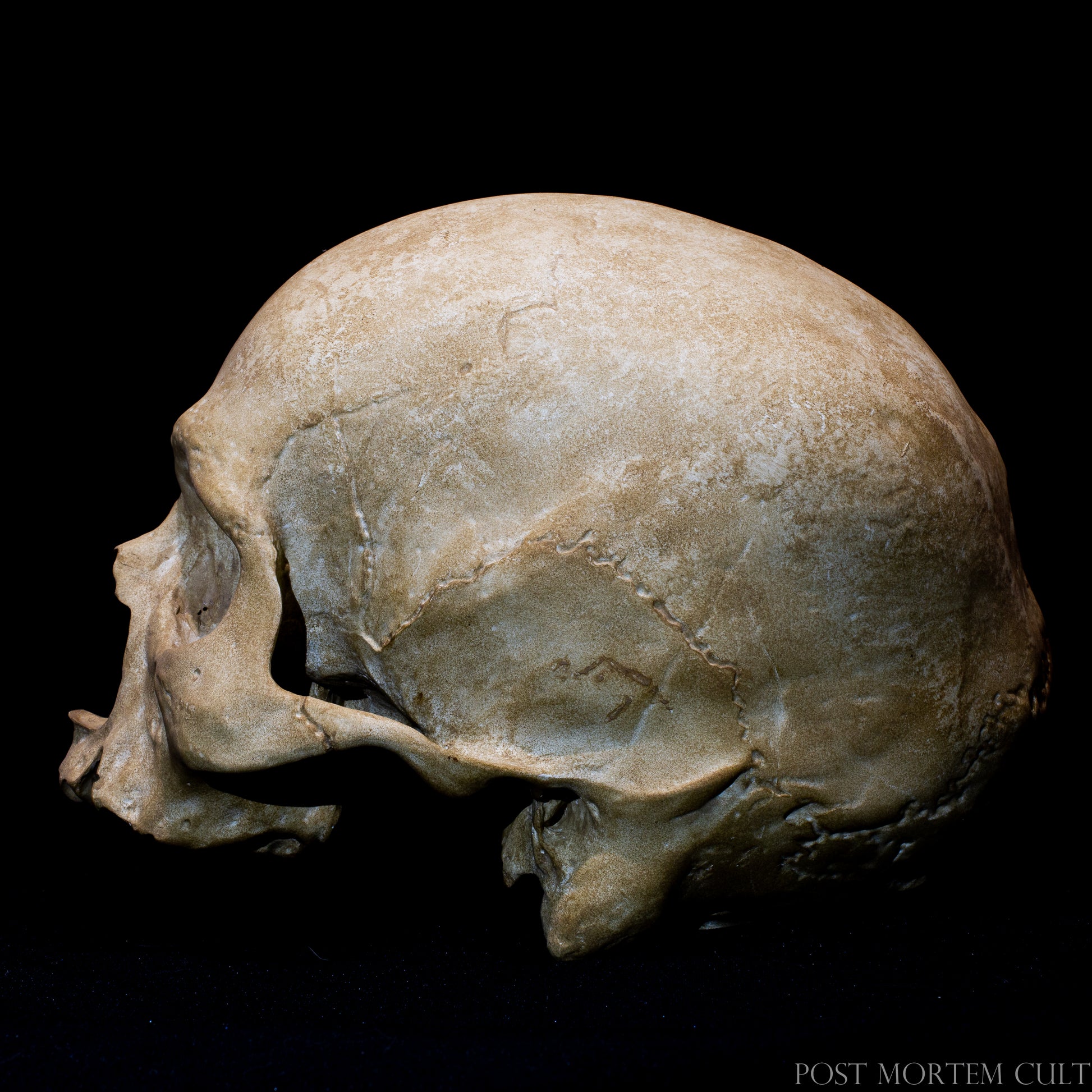 Close-up detail of anatomical skull replica highlighting cranial sutures, bone irregularities and aged osteological surface textures.
