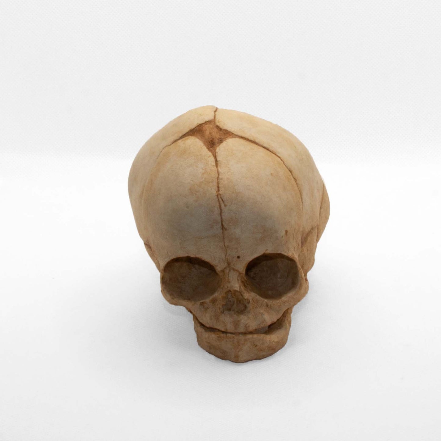 Side profile of the diprosopia fetal skull, perfect for scientific study, medical collections and dark academia décor setups.