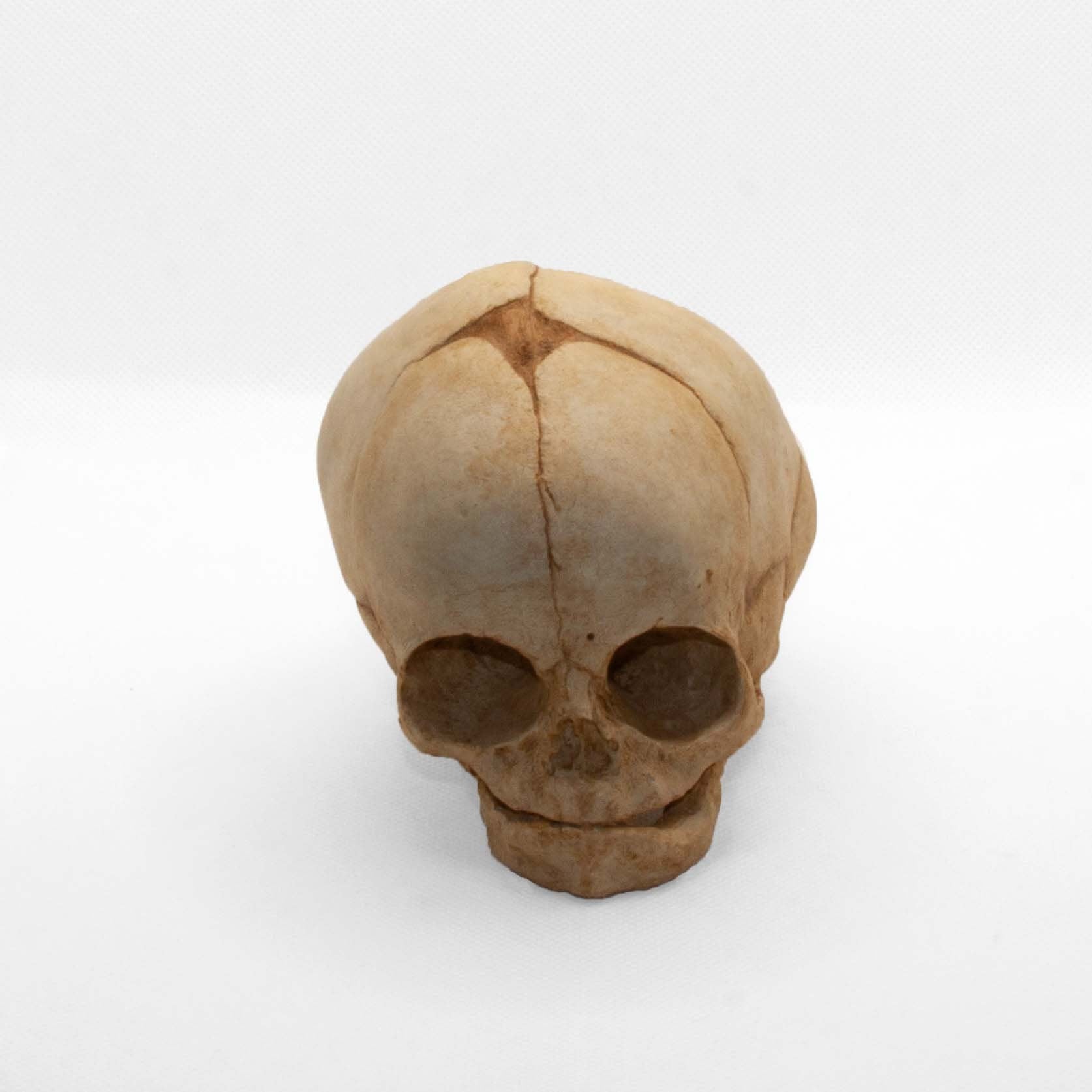 Side profile of the diprosopia fetal skull, perfect for scientific study, medical collections and dark academia décor setups.