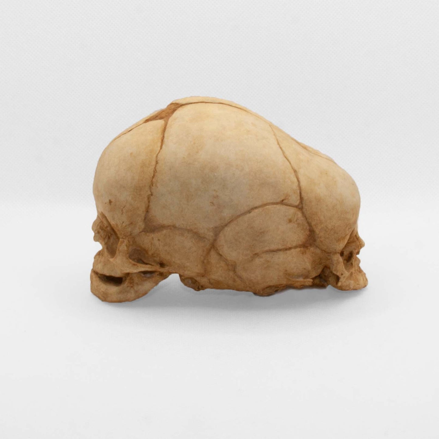 Front display of the Timmy Diprosopia Skull Replica, a striking centerpiece for any cabinet of curiosities or anatomical art collection.