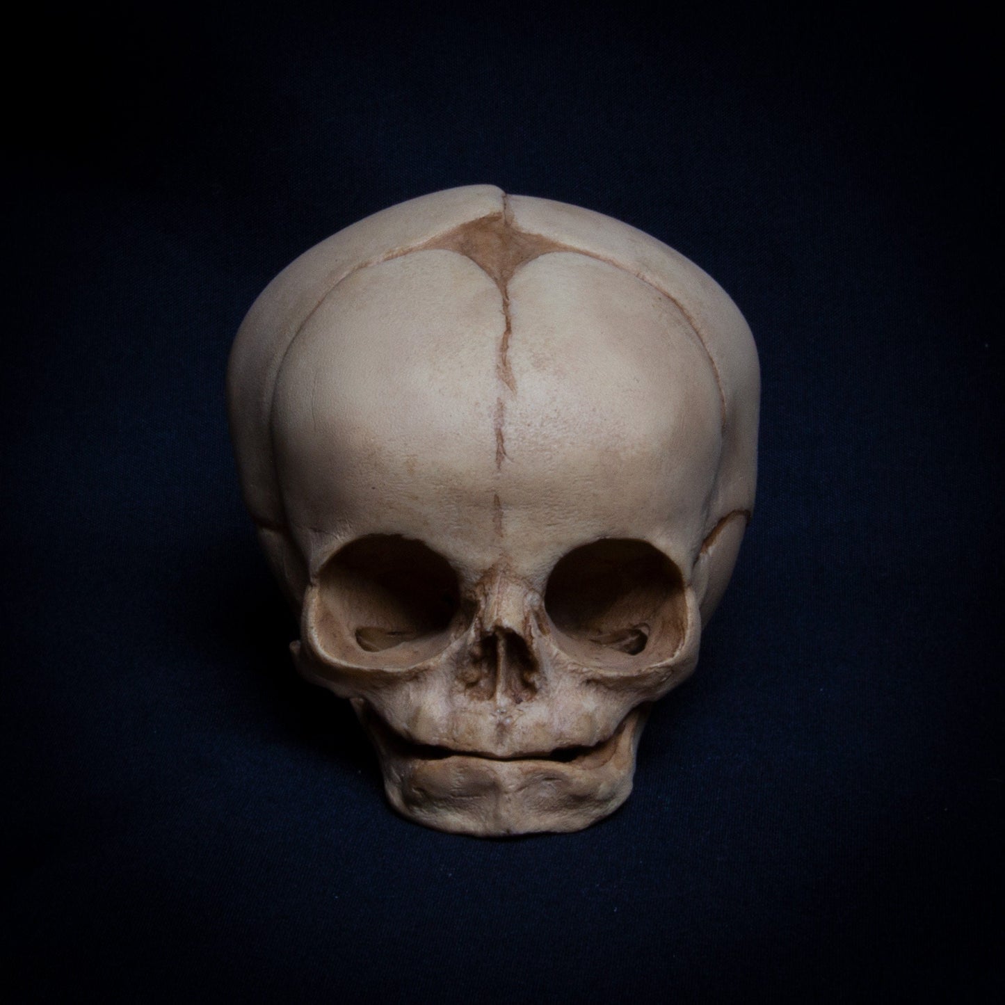 This antique fetal skull replica is a stunning piece, showcasing exceptional detail and realistic bone texture. Hand-painted with a subtle patina in soft beige tones, it mimics the natural aging process with remarkable precision. The fontanelle opening and finely detailed cranial sutures reflect the intricate development of fetal bones at 16 weeks. Ideal for collectors and anatomical studies, this model is a true work of art, capturing the authenticity and uniqueness of human development.