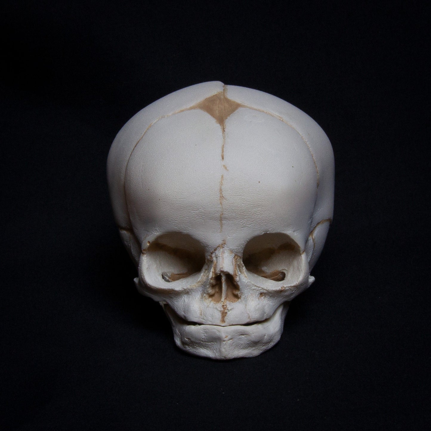 Crafted to the highest standards, this anatomical fetal skull replica features clear cranial sutures and a perfectly rendered fontanelle opening. The white tones of the skull provide a sharp contrast that highlights the anatomical accuracy of the bones. Every detail, from the smoothness of the frontal bones to the subtle texture of the parietal bones, is faithfully recreated. Perfect for studies or decorators, this piece offers a clinical yet highly realistic representation of human fetal anatomy.