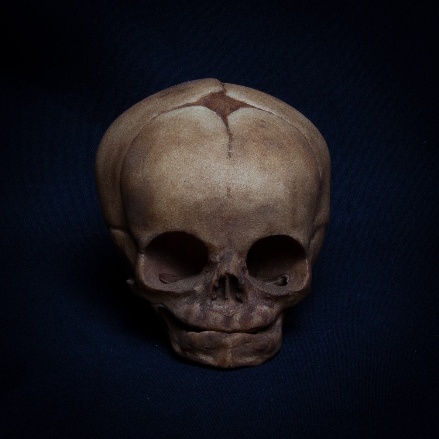 This unearthed fetal skull replica presents a raw, realistic look as if it were discovered during an excavation. The detailed porosity of the bone and the natural earth tones give this piece a unique, authentic feel. Carefully painted to simulate the wear and tear from natural decay, the skull’s fine details—like the deeper sutures and textured bone surfaces—showcase the realism of fetal skeletal development. Ideal for collectors who appreciate aged pieces or those looking to add an authentic, unique piece