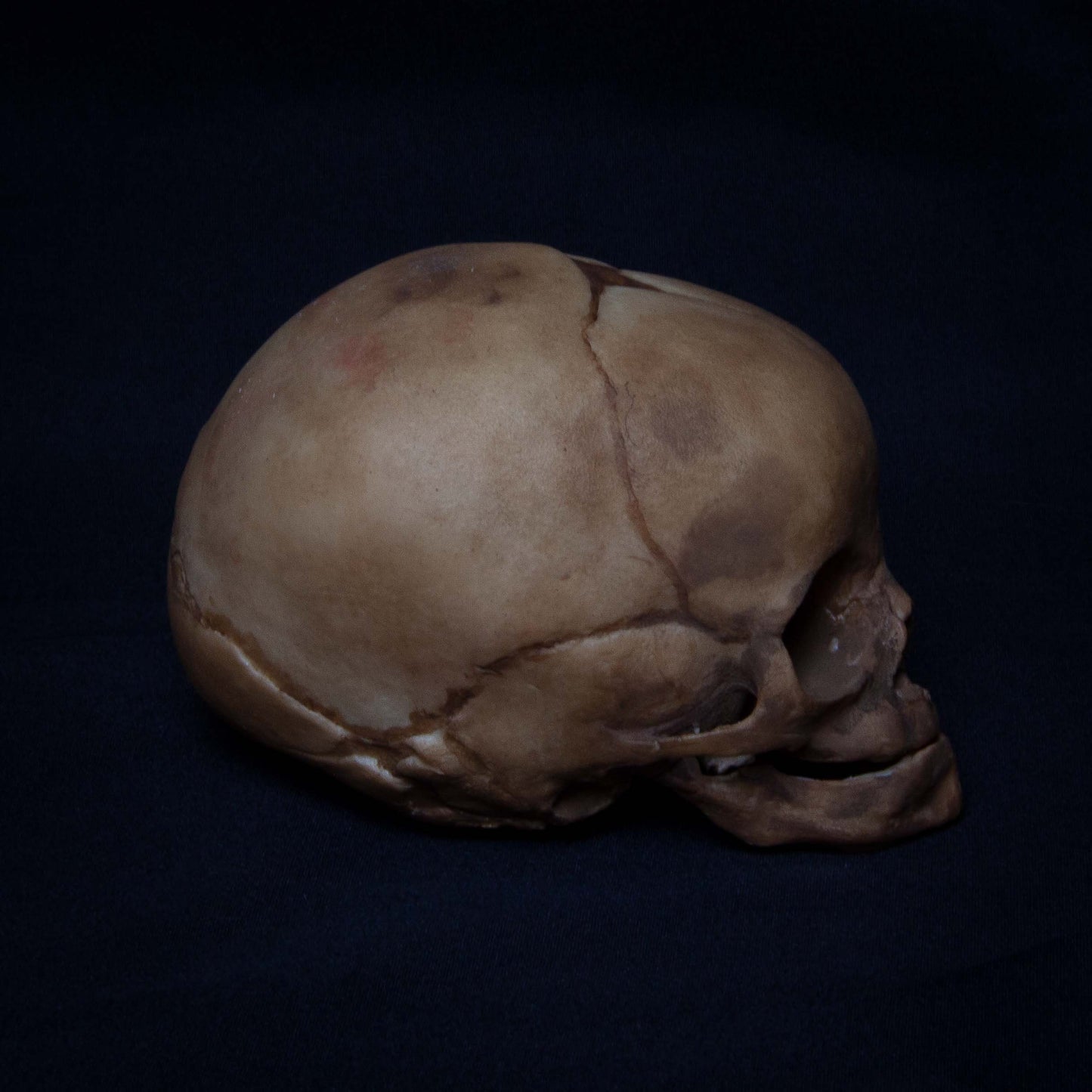 Resembling a fossilized skull found in an archaeological dig, this unearthed fetal skull replica is designed to evoke the raw beauty of ancient bone. The realistic porosity and detailed bone texture capture the natural wear of time, with imperfections and cracks that add to its authenticity. The fontanelle and cranial sutures are delicately rendered, showing the development of fetal bones at 16 weeks. A perfect choice for collectors who appreciate the aged, natural aesthetic or for those interested in study