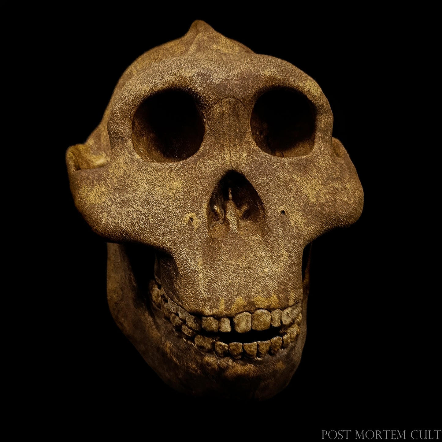 High-detail view of the temporal region, showcasing zygomatic arches and textured resin surface.