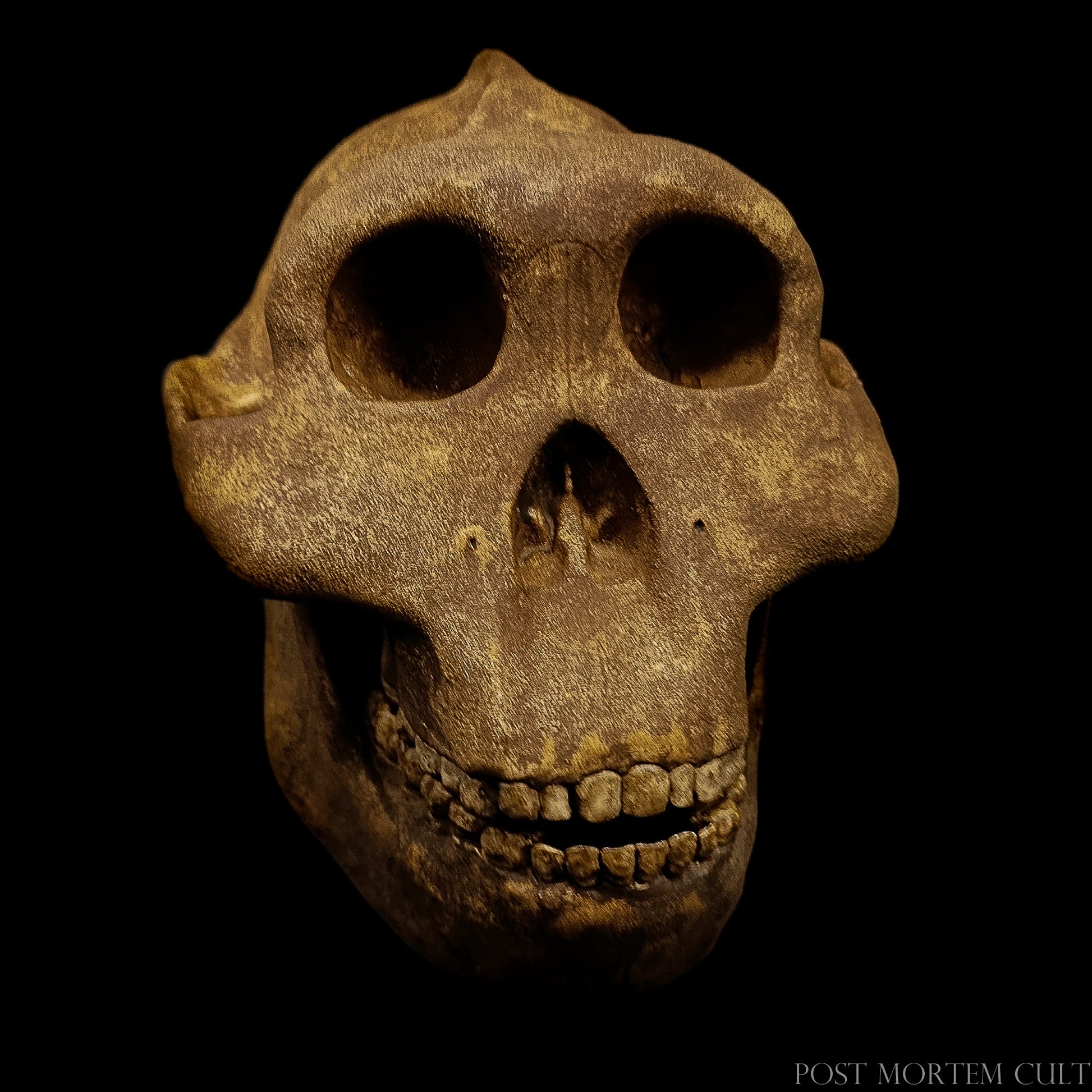 High-detail view of the temporal region, showcasing zygomatic arches and textured resin surface.